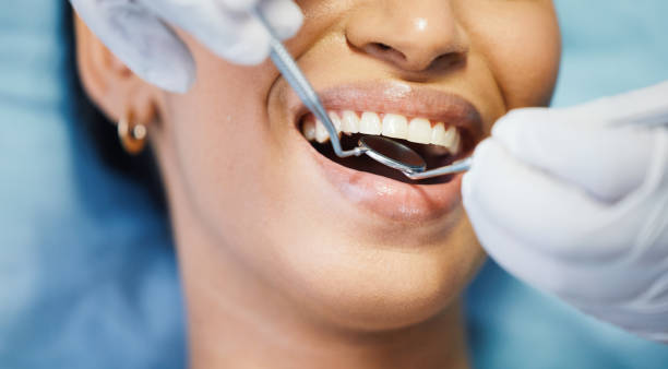 Best Dentist for Tooth Abscess  in Fenton, MI